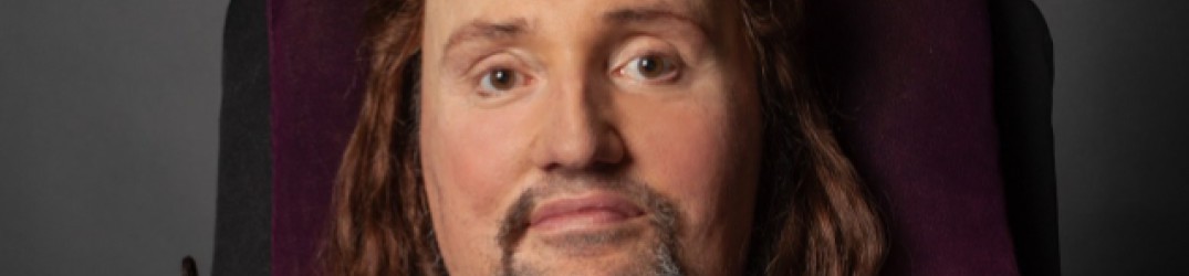 Jason Becker: la madre, ‘L’operazione è andata bene’