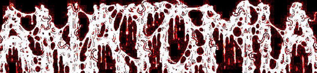 Anatomia: split con i Surgikill