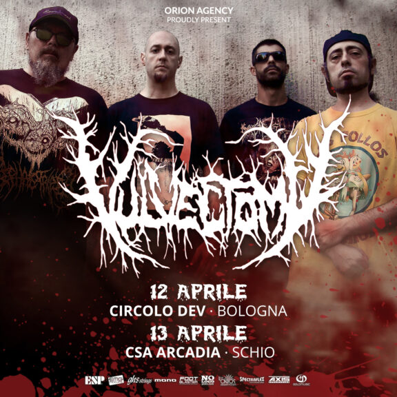 Vulvectomy: due date a Bologna e Schio (VI)